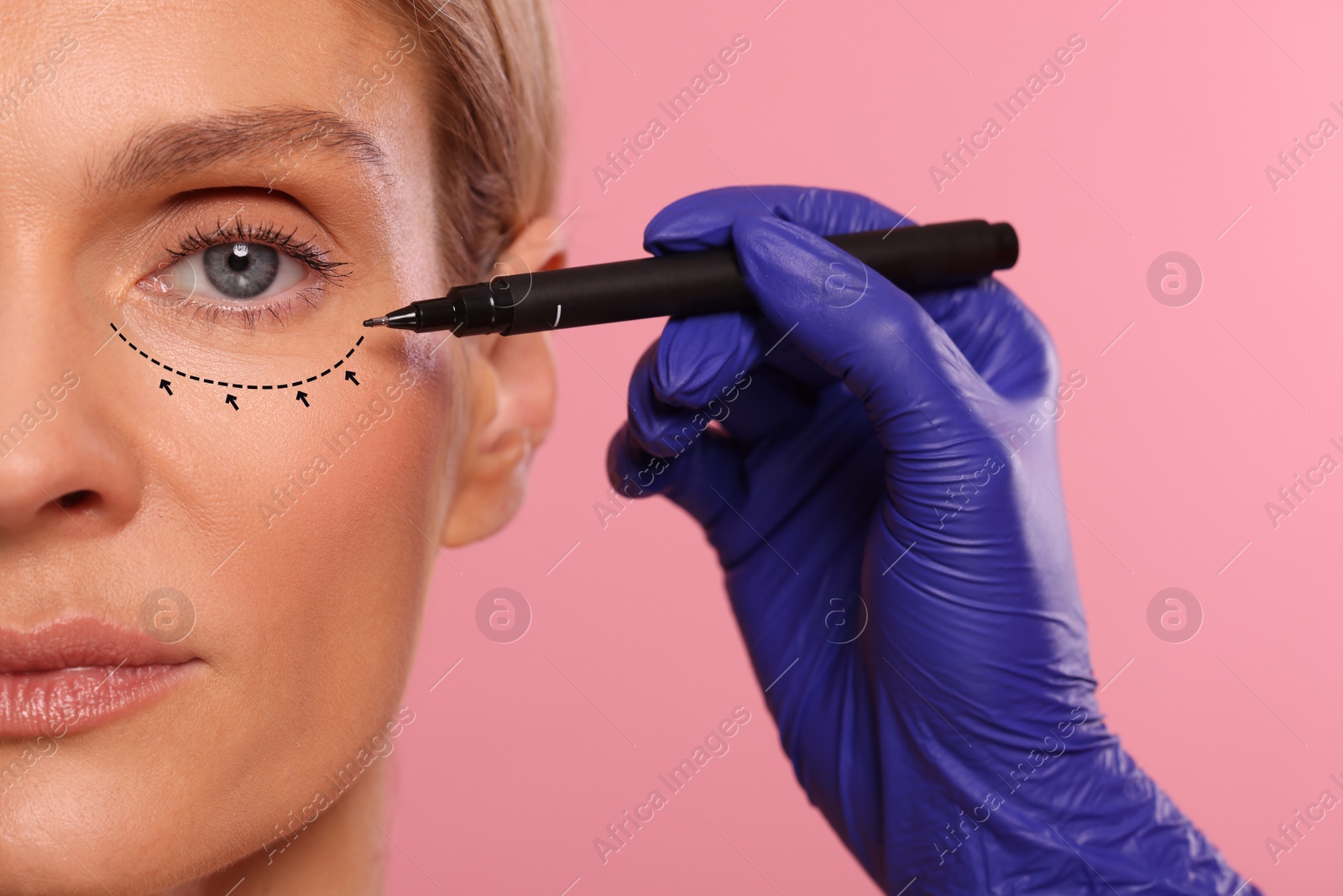 Image of Woman preparing for cosmetic surgery, pink background. Doctor drawing markings on her face, closeup