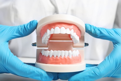 Photo of Dentist holding educational model of oral cavity with teeth at workplace, closeup