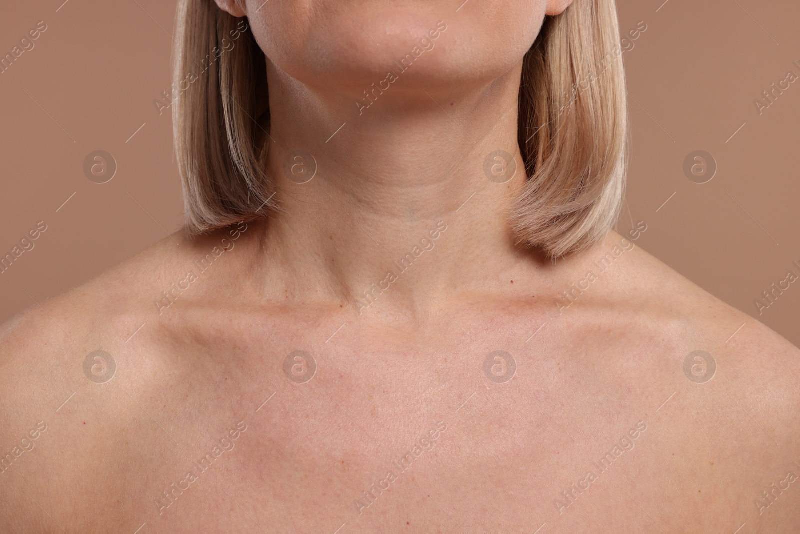 Photo of Woman with healthy skin on beige background, closeup