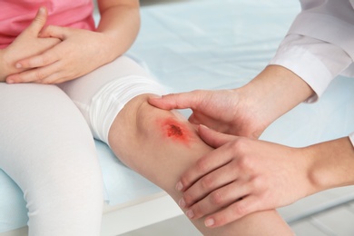 Photo of Female doctor examining little girl's injured leg in clinic, closeup. First aid