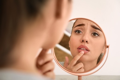 Photo of Emotional woman with herpes touching lips in front of mirror against light background