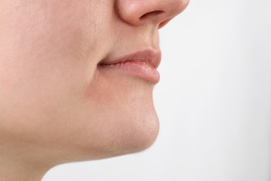 Woman with dry skin on white background, closeup view. Space for text