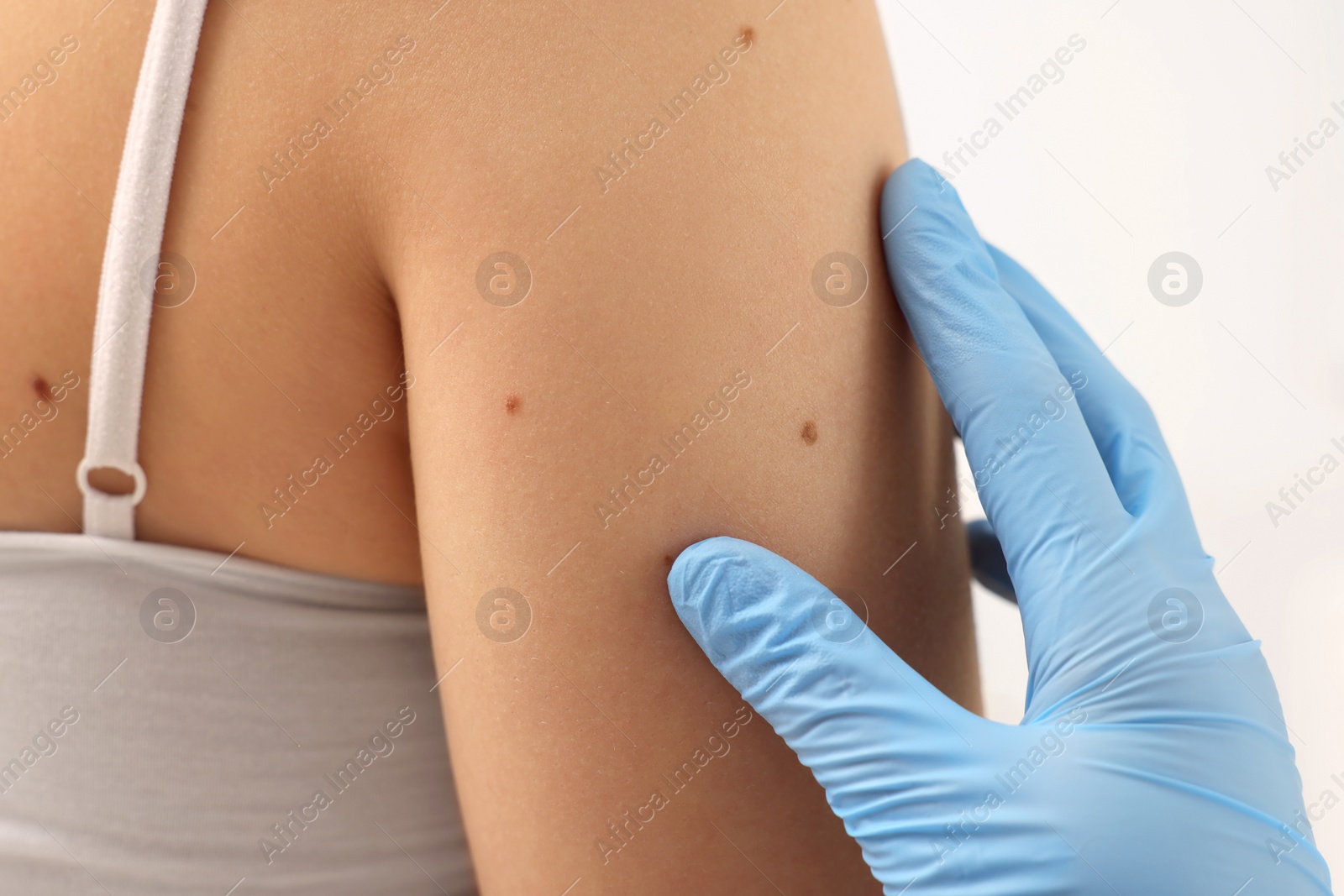 Photo of Dermatologist examining patient's birthmark on beige background, closeup