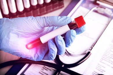 Laboratory worker holding test tube with blood sample over table, closeup. Color toned