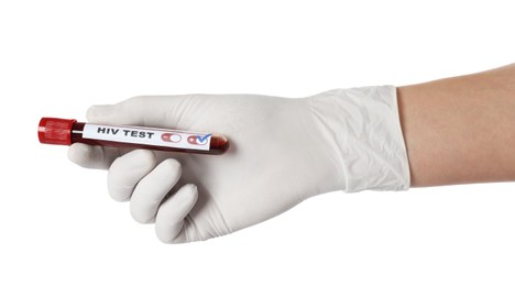 Photo of Scientist holding tube with blood sample and label HIV Test on white background, closeup