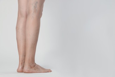 Closeup view of woman with varicose veins on light background. Space for text