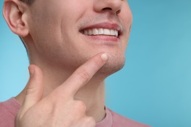 Young man showing his teeth with whitening strip on light blue background, closeup. Space for text