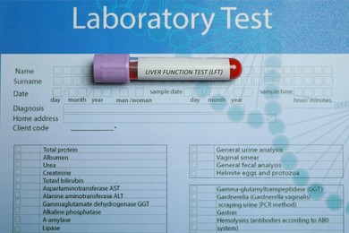 Liver Function Test. Tube with blood sample on laboratory form, top view