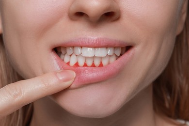 Image of Woman showing inflamed gum, closeup. Oral cavity health