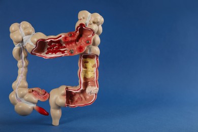 Photo of Human colon model on blue background. Space for text
