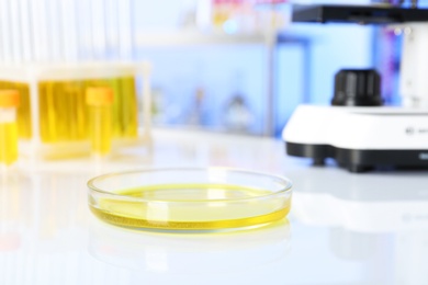 Photo of Petri dish with urine sample for analysis on table in laboratory
