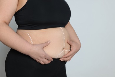 Photo of Closeup view of obese woman with marks on body against light background, space for text. Weight loss surgery
