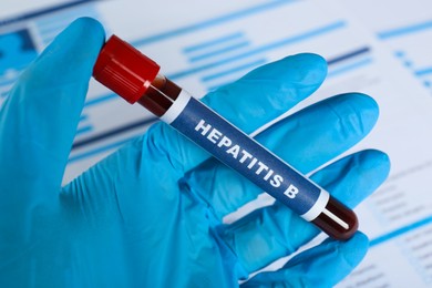 Photo of Scientist holding tube with blood sample and label Hepatitis B against laboratory test form, closeup