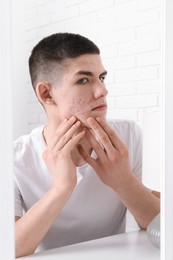 Photo of Upset young man looking at mirror and touching pimple on his face indoors. Acne problem