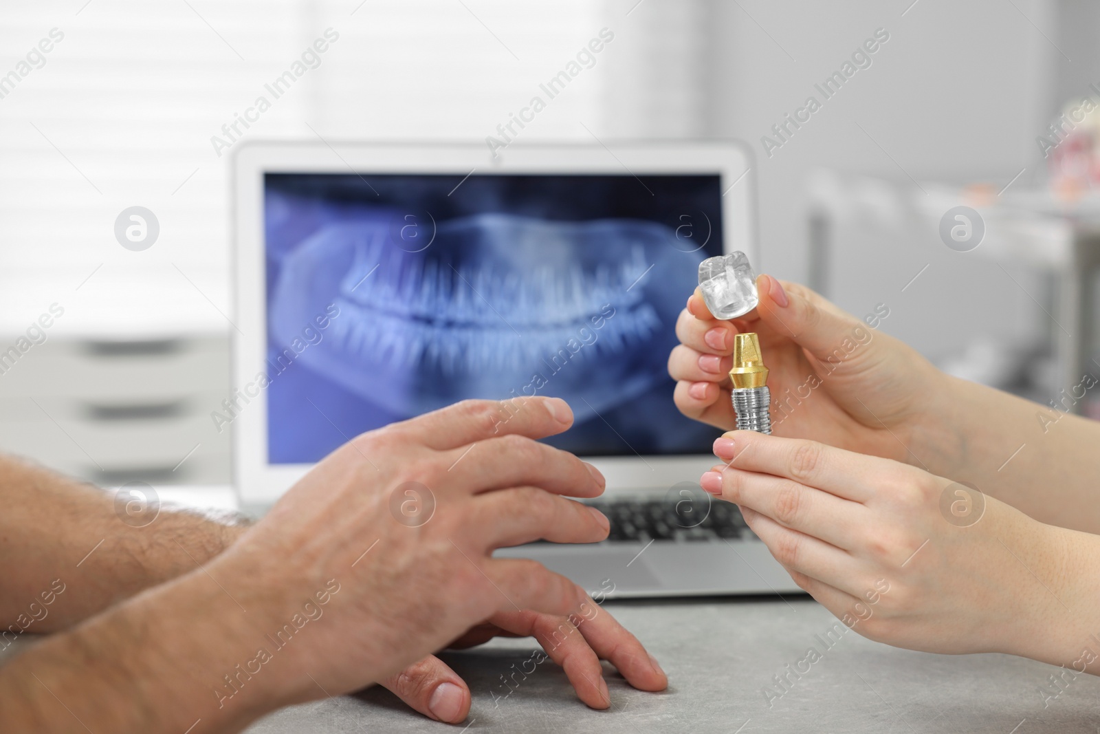 Photo of Doctor showing patient educational model of dental implant in clinic, closeup