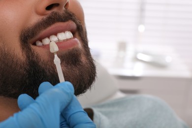 Photo of Dentist checking young man's teeth color in clinic, closeup