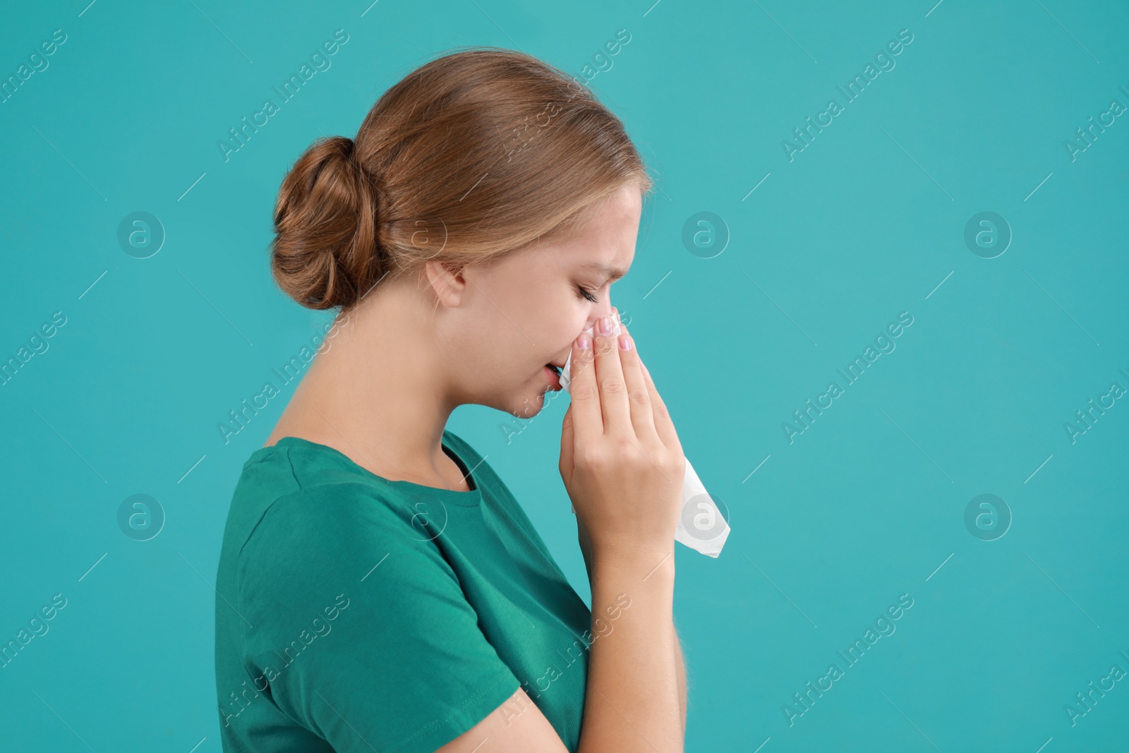 Photo of Young woman suffering from allergy on turquoise background