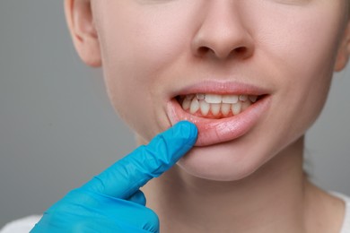 Doctor examining woman's gums on grey background, closeup