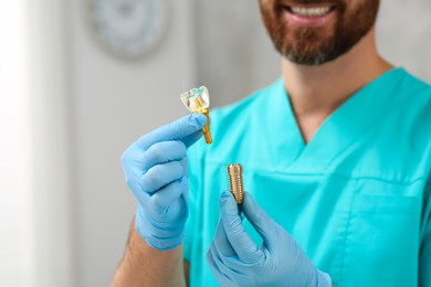 Photo of Dentist holding educational model of dental implant on blurred background, closeup. Space for text