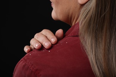 Woman brushing dandruff off her shirt on black background, closeup