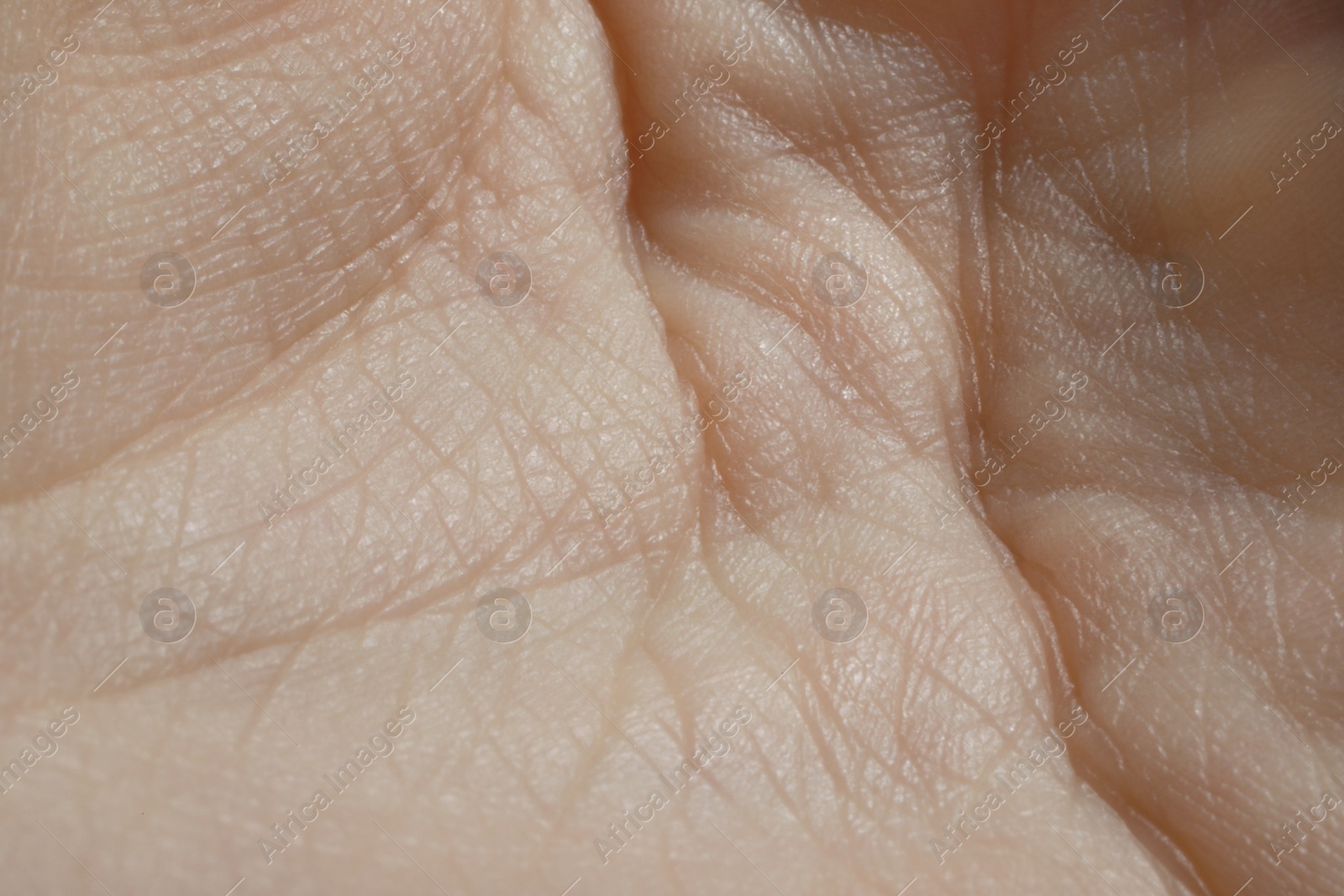 Photo of Closeup view of human hand with dry skin