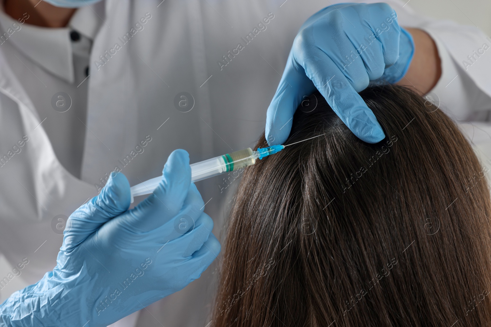 Photo of Trichologist giving injection to patient, closeup view