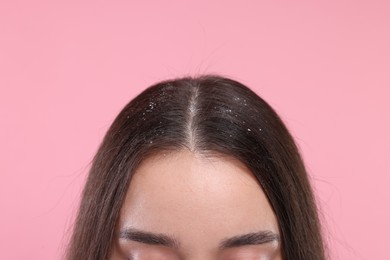 Photo of Woman with dandruff problem on pink background, closeup