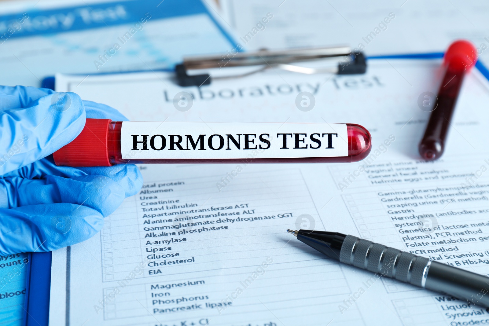 Photo of Hormones test. Scientist holding sample tube with blood against laboratory form, closeup