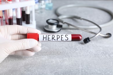Photo of Doctor in glove holding test tube with word Herpes at grey table, closeup