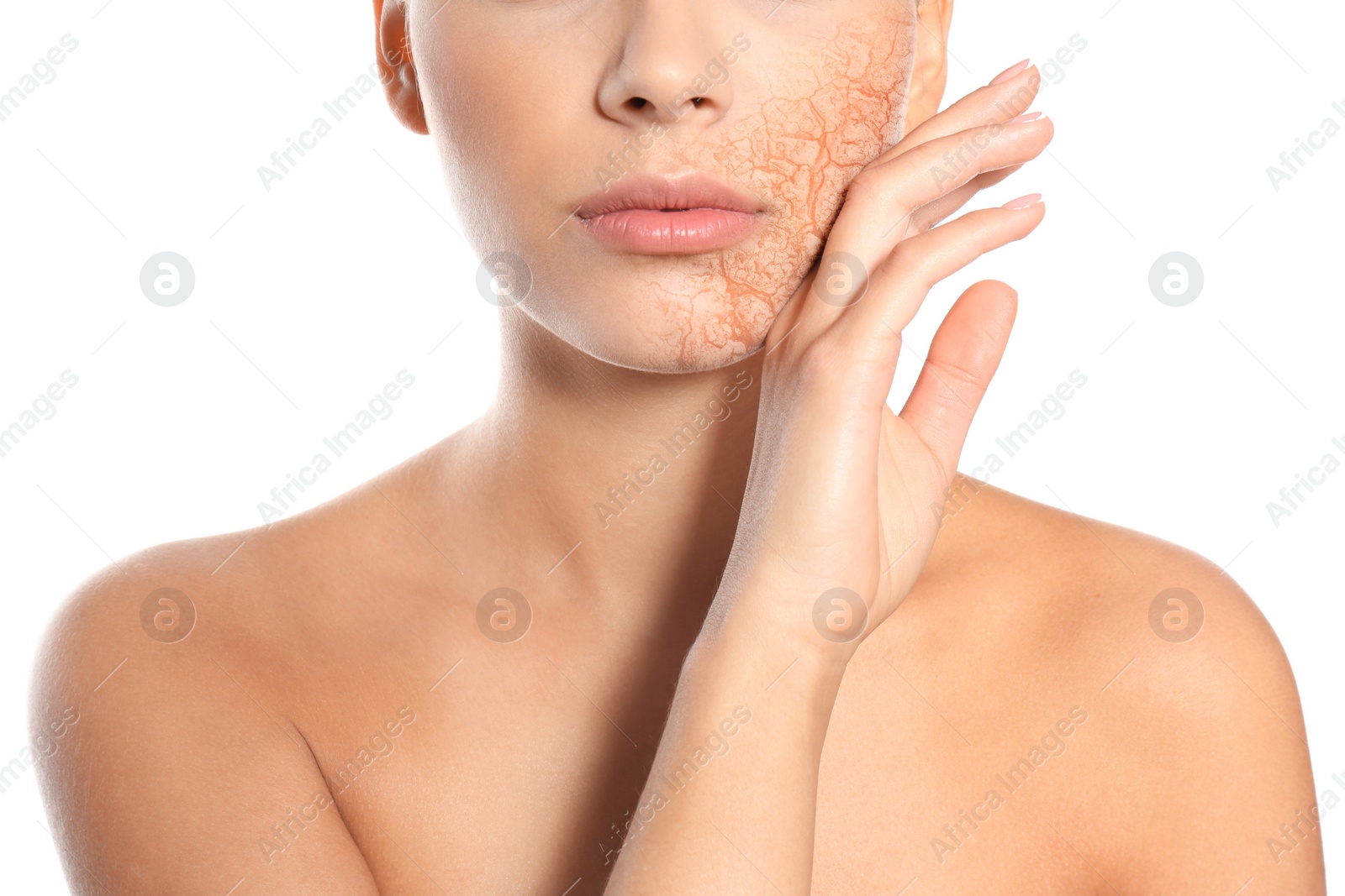 Image of Beautiful young woman with dry skin on white background, closeup