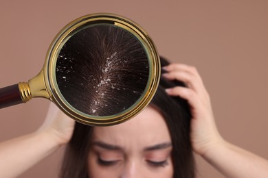 Image of Woman suffering from dandruff on pale brown background, closeup. View through magnifying glass on hair with flakes