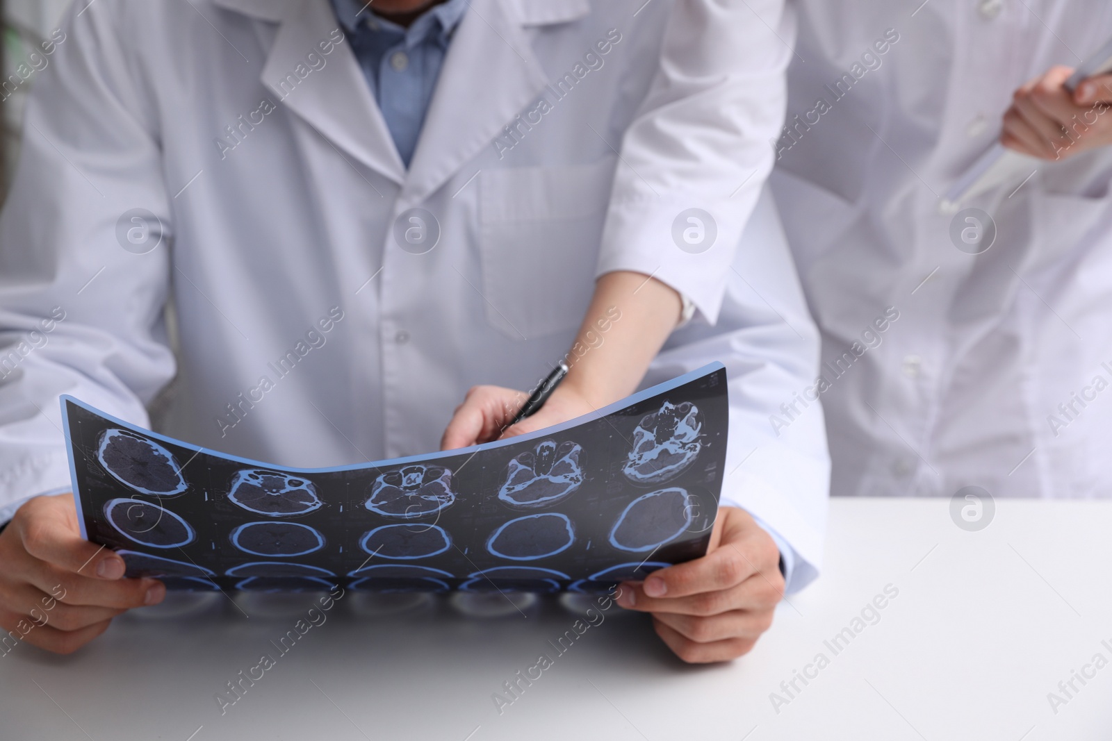 Photo of Doctors examining MRI images of patient with multiple sclerosis in clinic, closeup