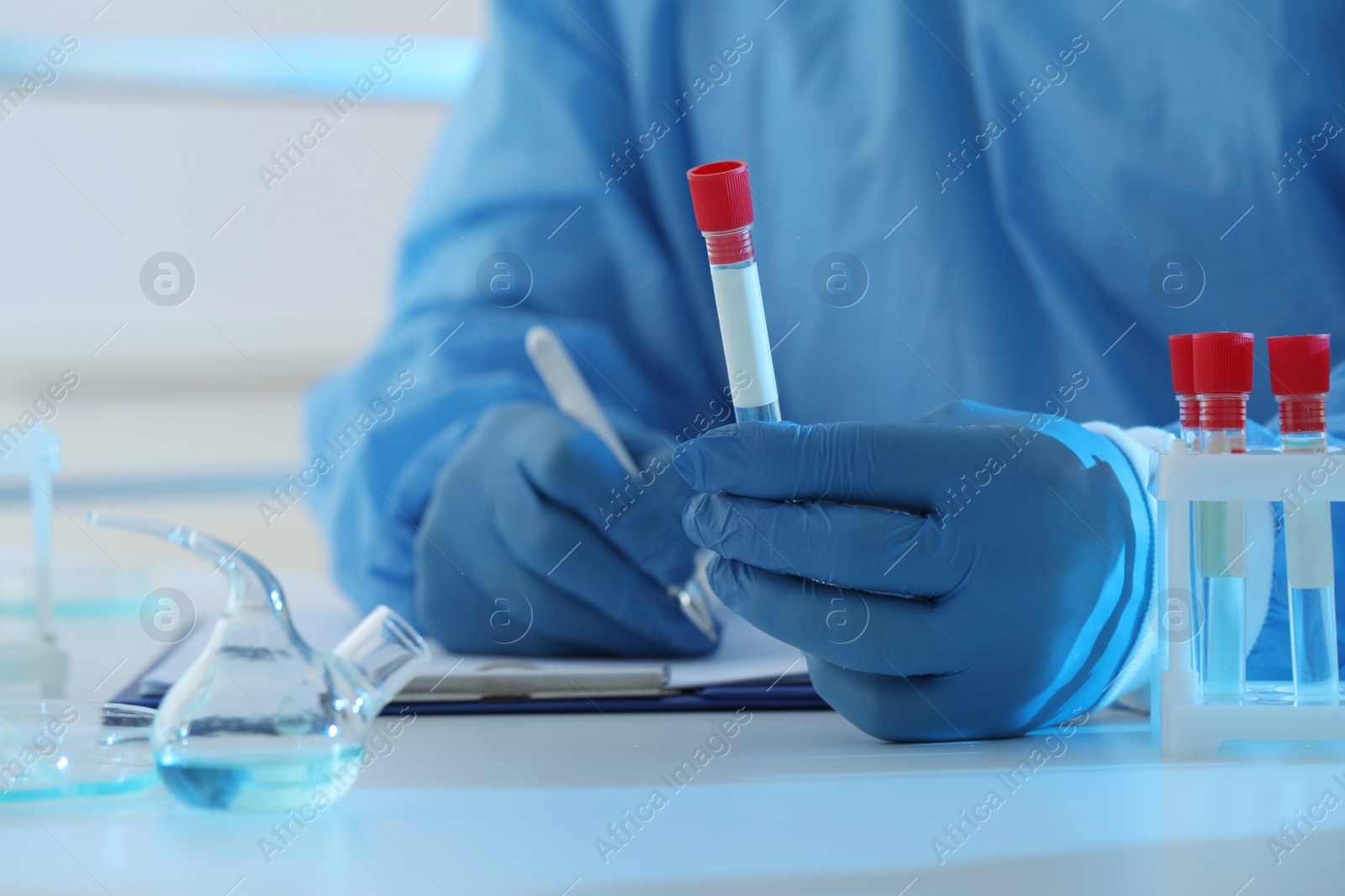 Photo of Scientist working at table, closeup. Medical research