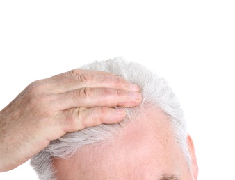 Photo of Senior man with hair loss problem isolated on white, closeup