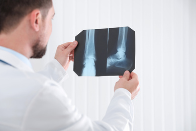 Photo of Professional orthopedist examining X-ray picture in his office, focus on hands