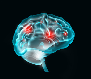 Illustration of  human brain on black background