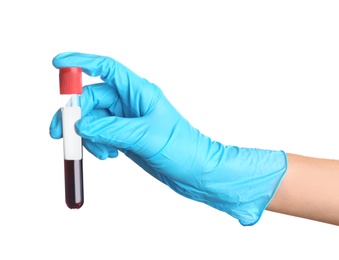 Photo of Doctor holding glass tube with blood on white background, closeup. Allergy test