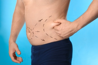 Photo of Man with marks on belly for cosmetic surgery operation against blue background, closeup