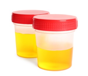 Containers with urine sample for analysis on white background