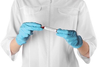 Monkeypox virus diagnosis. Laboratory worker holding test tube with blood sample on white background, closeup