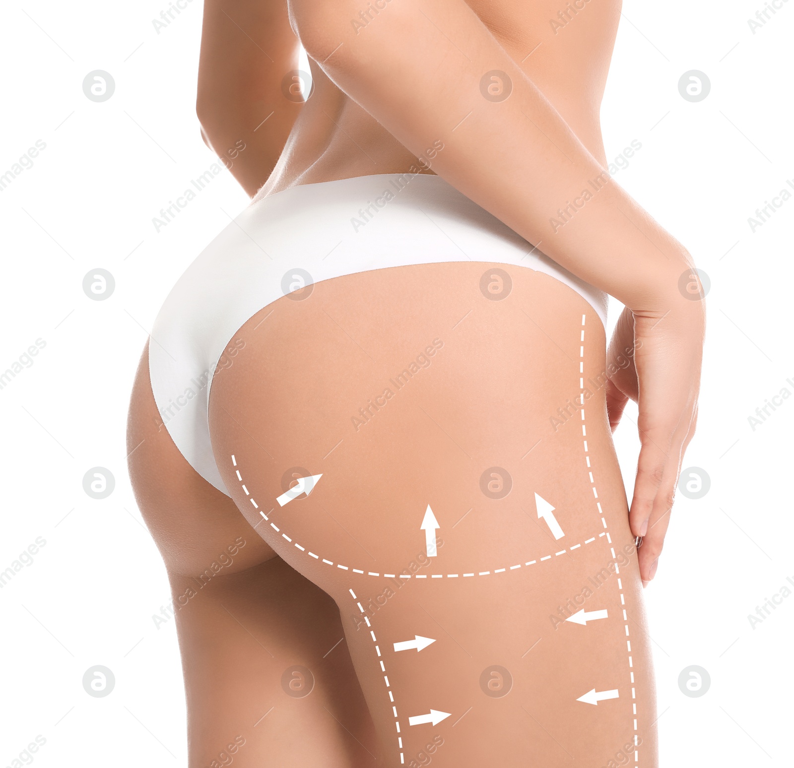 Image of Slim young woman with marks on body for cosmetic surgery operation against white background, closeup