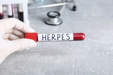 Doctor in glove holding test tube with word Herpes at grey table, closeup