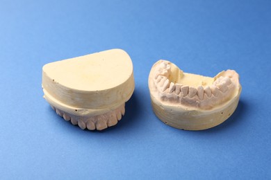 Dental model with gums on blue background. Cast of teeth