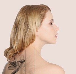 Image of Design with photo of woman on beige background during tattoo removal process