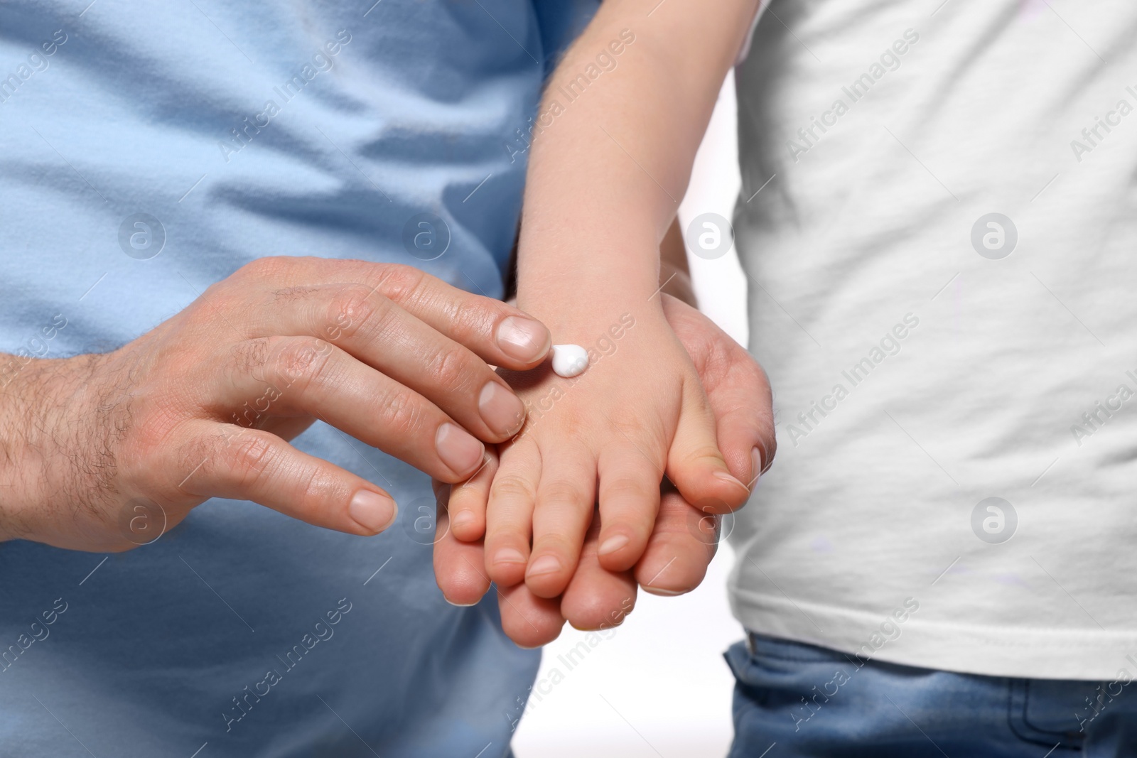 Photo of Father applying ointment onto his daughter's hand against white background, closeup