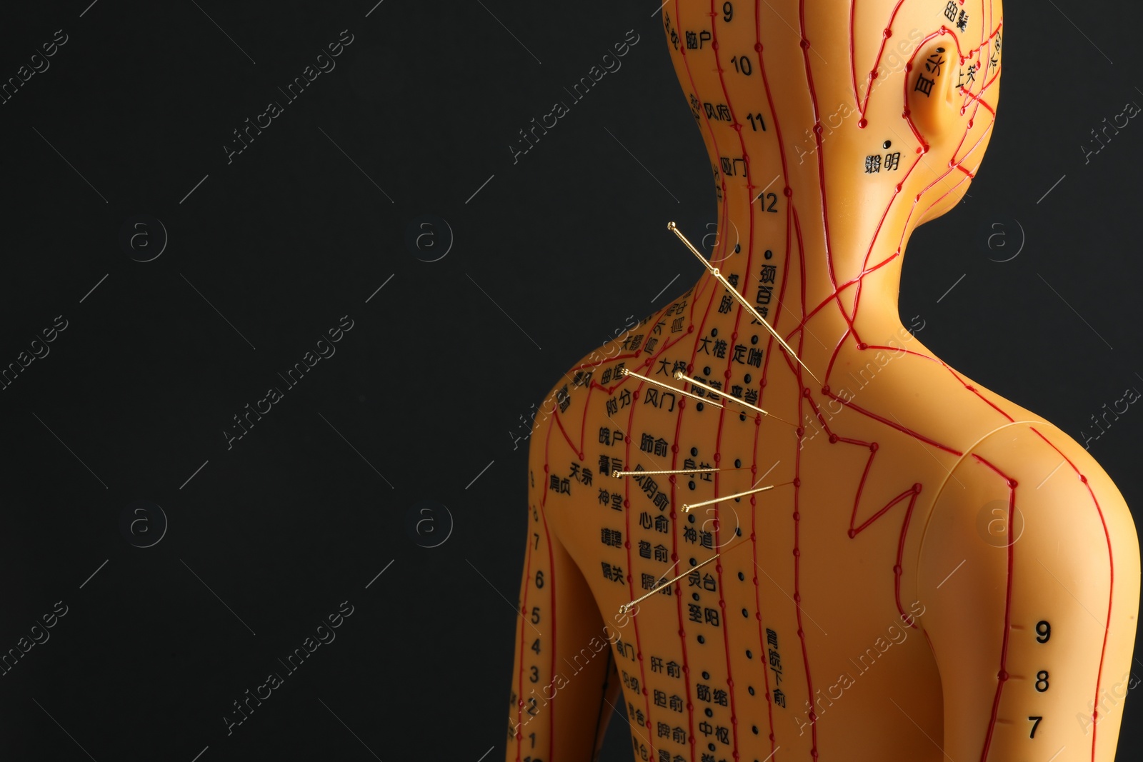 Photo of Acupuncture - alternative medicine. Human model with needles in back against black background, space for text