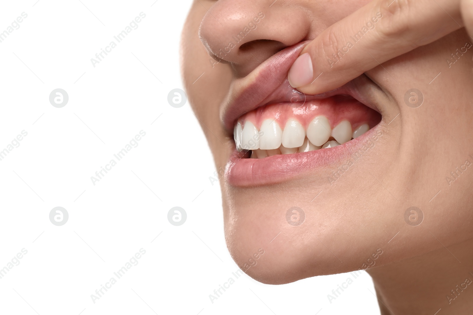 Photo of Woman showing healthy gums on white background, closeup