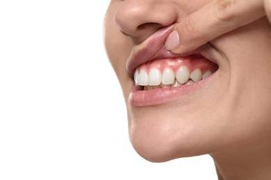 Woman showing healthy gums on white background, closeup