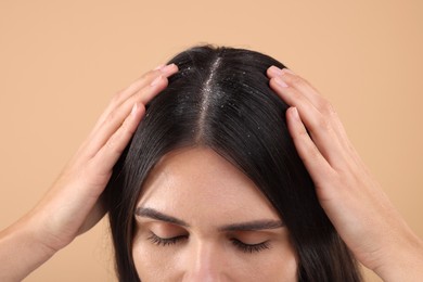 Photo of Woman examining her hair and scalp on beige background, closeup. Dandruff problem