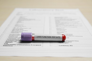 Photo of Liver Function Test. Tube with blood sample and laboratory form on table, closeup